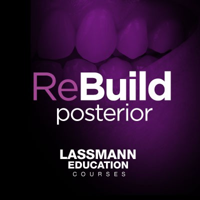 ReBulid: Posterior